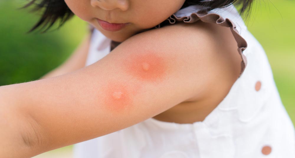 Wespennest entfernen lassen und die Kinder und Haustiere schützen